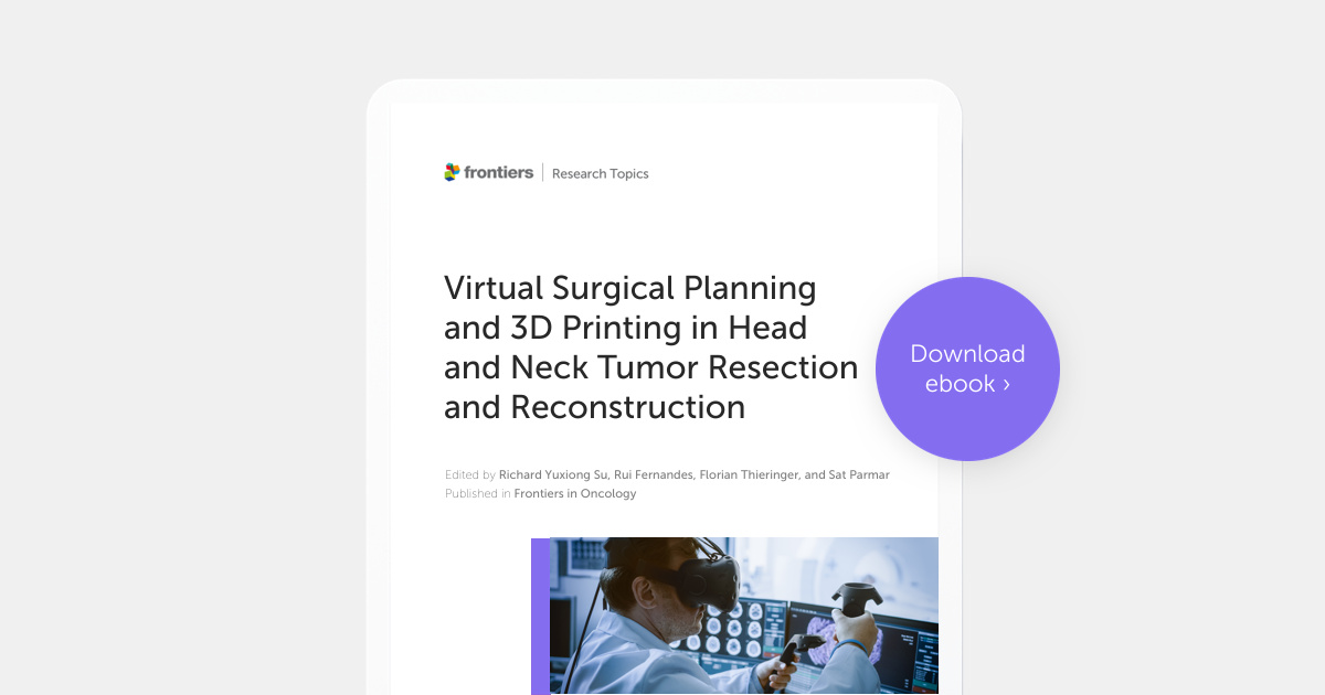 📖New eBook launched: "Virtual Surgical Planning and 3D Printing in Head and Neck Tumor Resection and Reconstruction" Edited by Dr. Richard Su, Dr. Rui Fernandes, Dr. Florian Thieringer and Dr. Sat Parmar 

Free to download here 👉fro.ntiers.in/gKjz