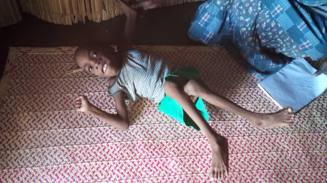 KINTU ENOCK DAUSON needs your prayers. He has acute Arthritis and paralysis since his birth.