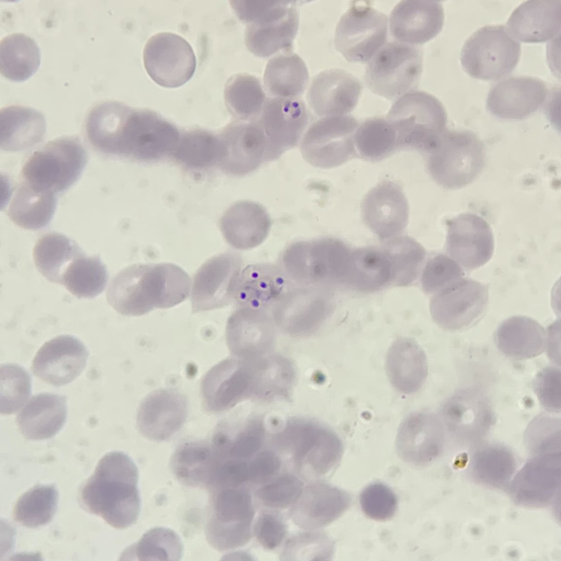 TheBeiLab's tweet photo. We’re hiring! Are you excited to understand the functional impact of genetic diversity on malaria vaccine efficacy in both lab and field? Do you want to be part of a truly awesome cross-continental lab family? If so, apply for this fully-funded post-doc position in the Bei Lab! https://t.co/i5muucPn23