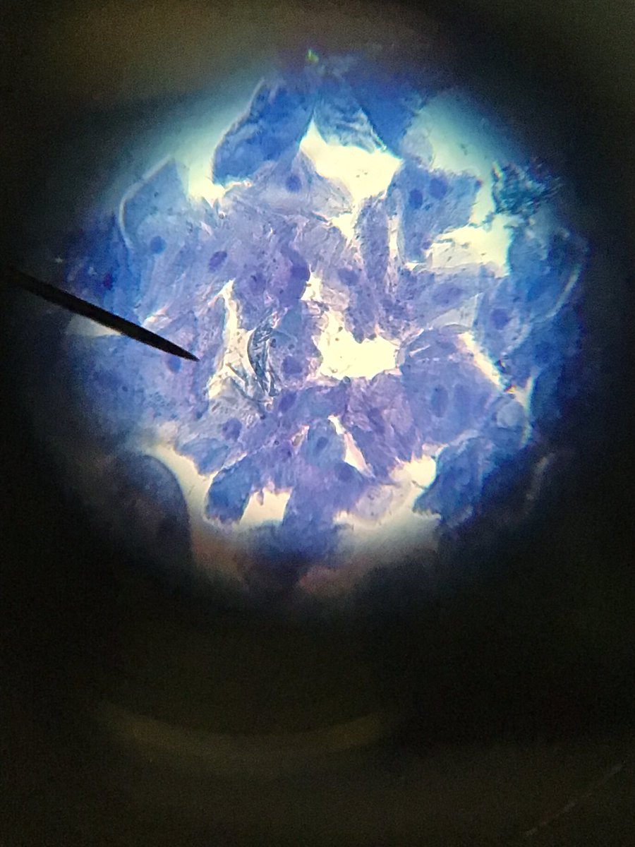 OrleyFarmSchool's tweet photo. Meet Krish, one of our Year 7 students.
Well, Krish's very own cheek epithelial cells to be exact!
Did you know that those cells divide every 24 hours and are constantly shed from the body?
#OFSscience
#Microscopy
#edutwitter https://t.co/g9hXtmzVFN