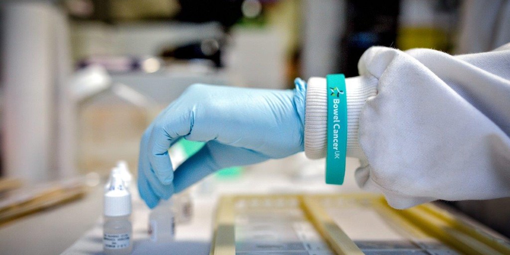 bowelcanceruk's tweet photo. 📢 Calling all researchers, we’re delighted to announce we’re now accepting applications for pilot grants aimed at increasing early diagnosis of #bowelcancer. 🔬 

Full details on our website: https://t.co/uzSxQH0bBW

#earlydiagnosis #research https://t.co/W4Kkz9NREF