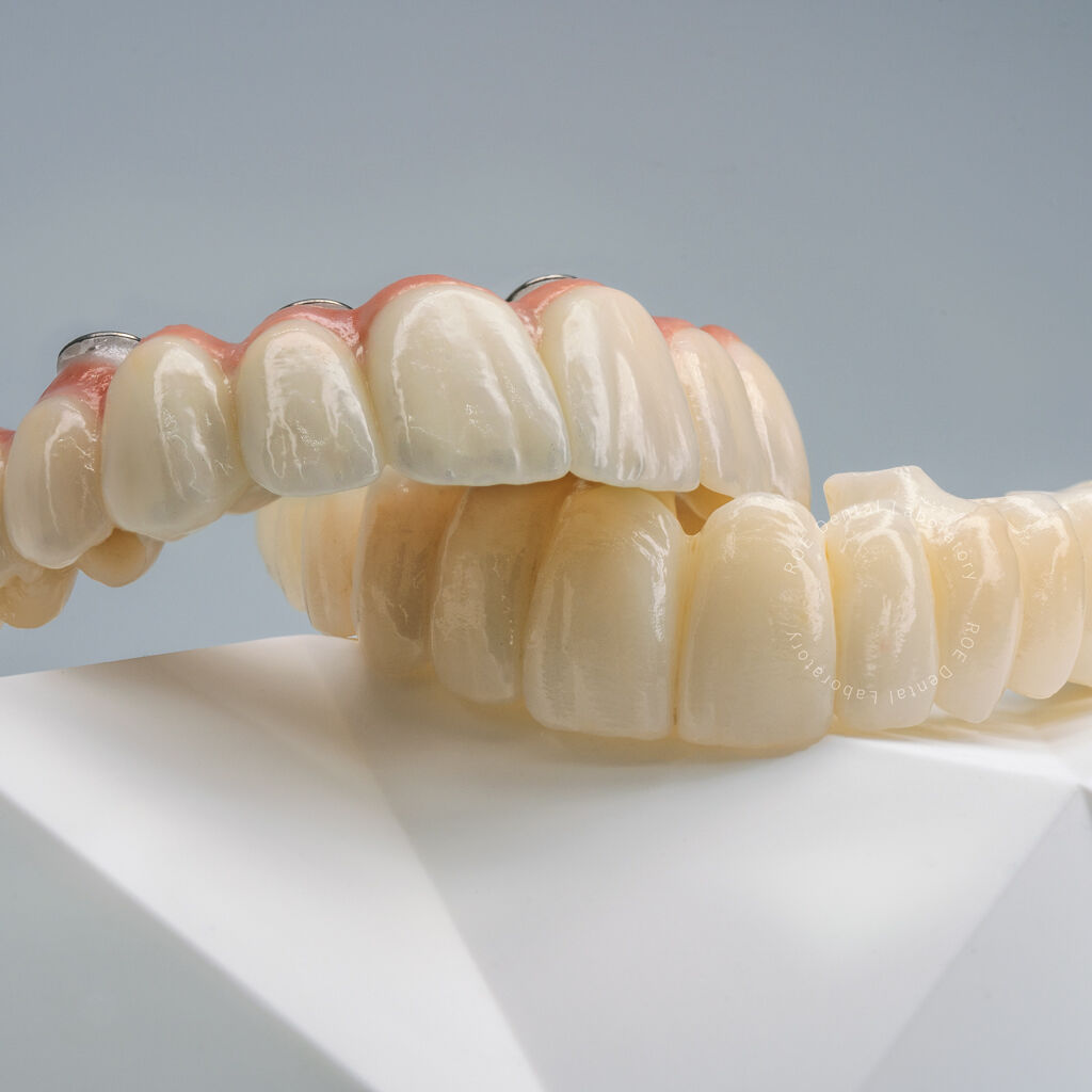 ROE Dental Lab tweet media