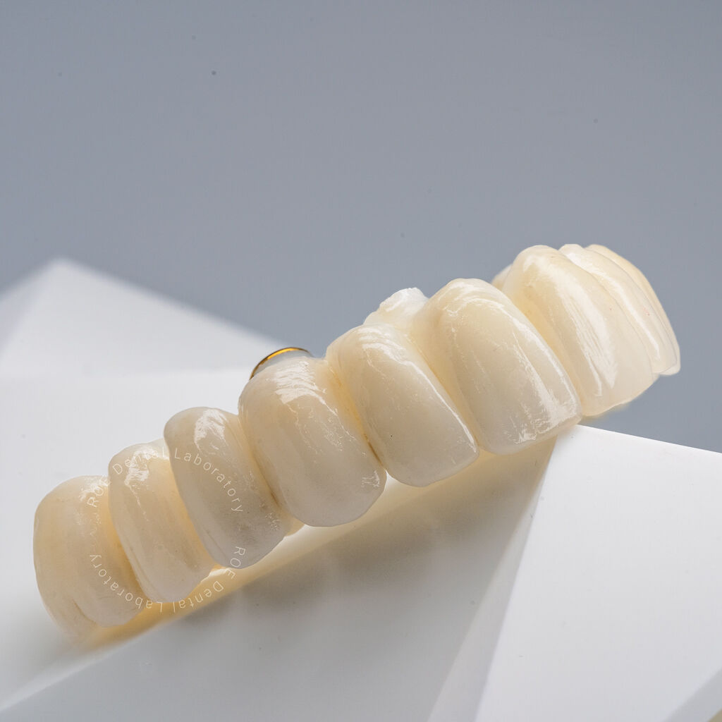 ROE Dental Lab tweet media