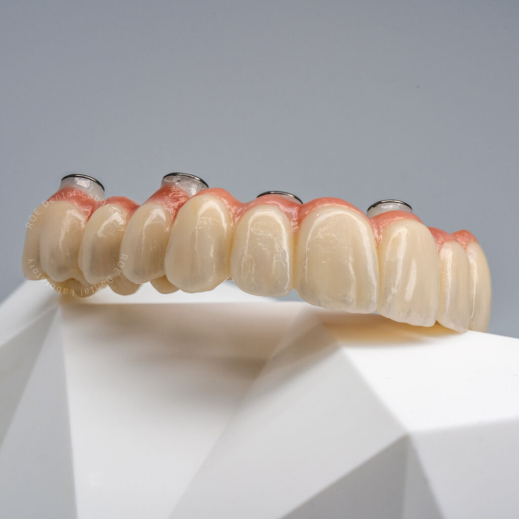 ROE Dental Lab tweet media