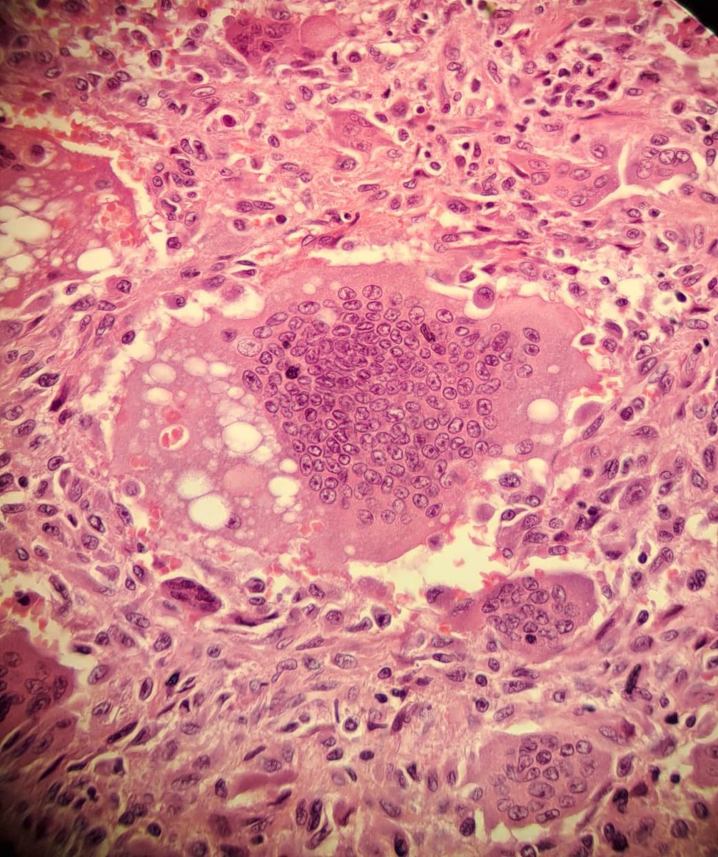 LeanRichCalm's tweet photo. @smlungpathguy Any suggestions? https://t.co/YRpg1MJmmu