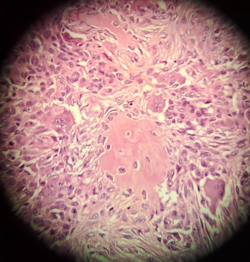 LeanRichCalm's tweet photo. @smlungpathguy Any suggestions? https://t.co/YRpg1MJmmu