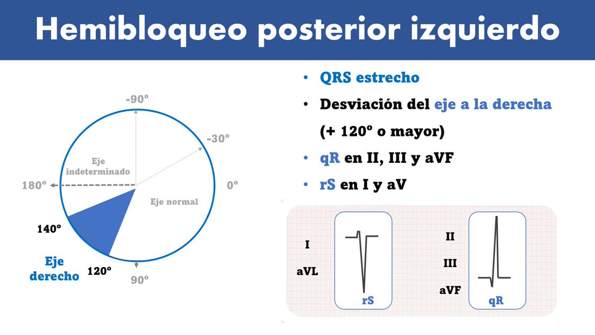 Como hemos prometido, aquí os dejamos el #CardioTruco del hemibloqueo posterior de rama izquierda. Como recibamos tanto amor ❤️ como en el de ayer ya no sé lo que os vamos a dar...🥰