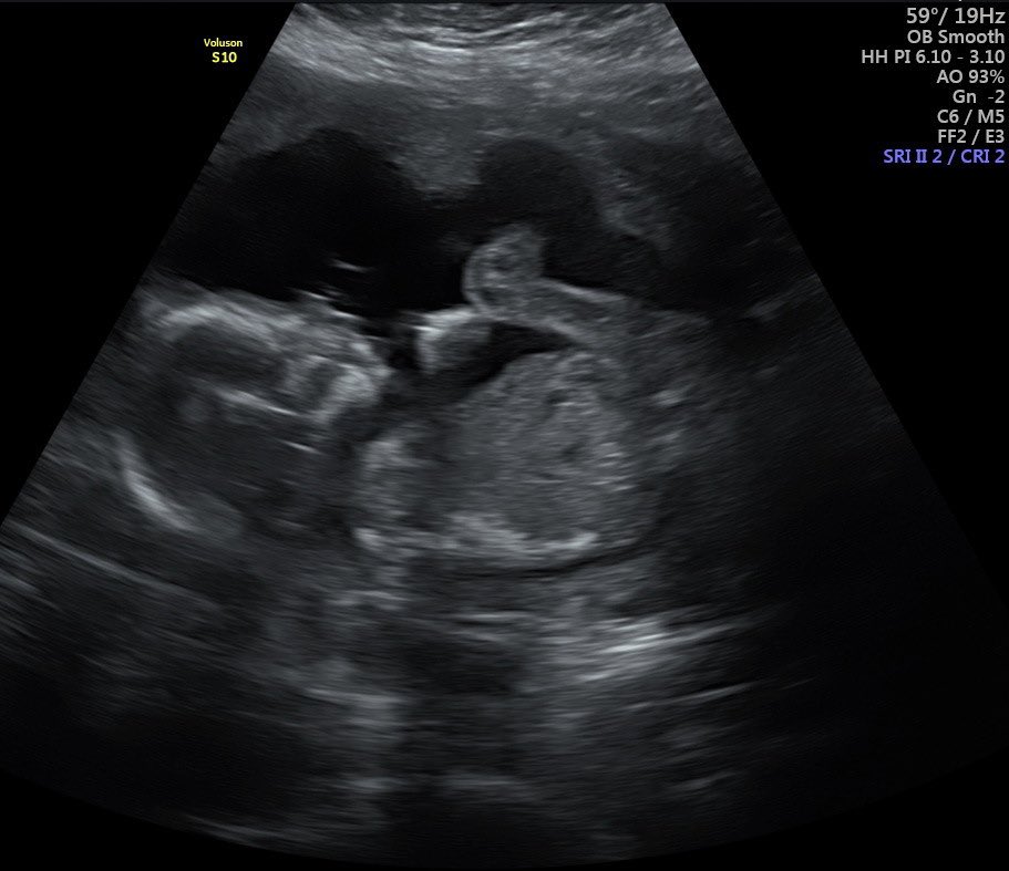 Baby boy Luca 🌿💚