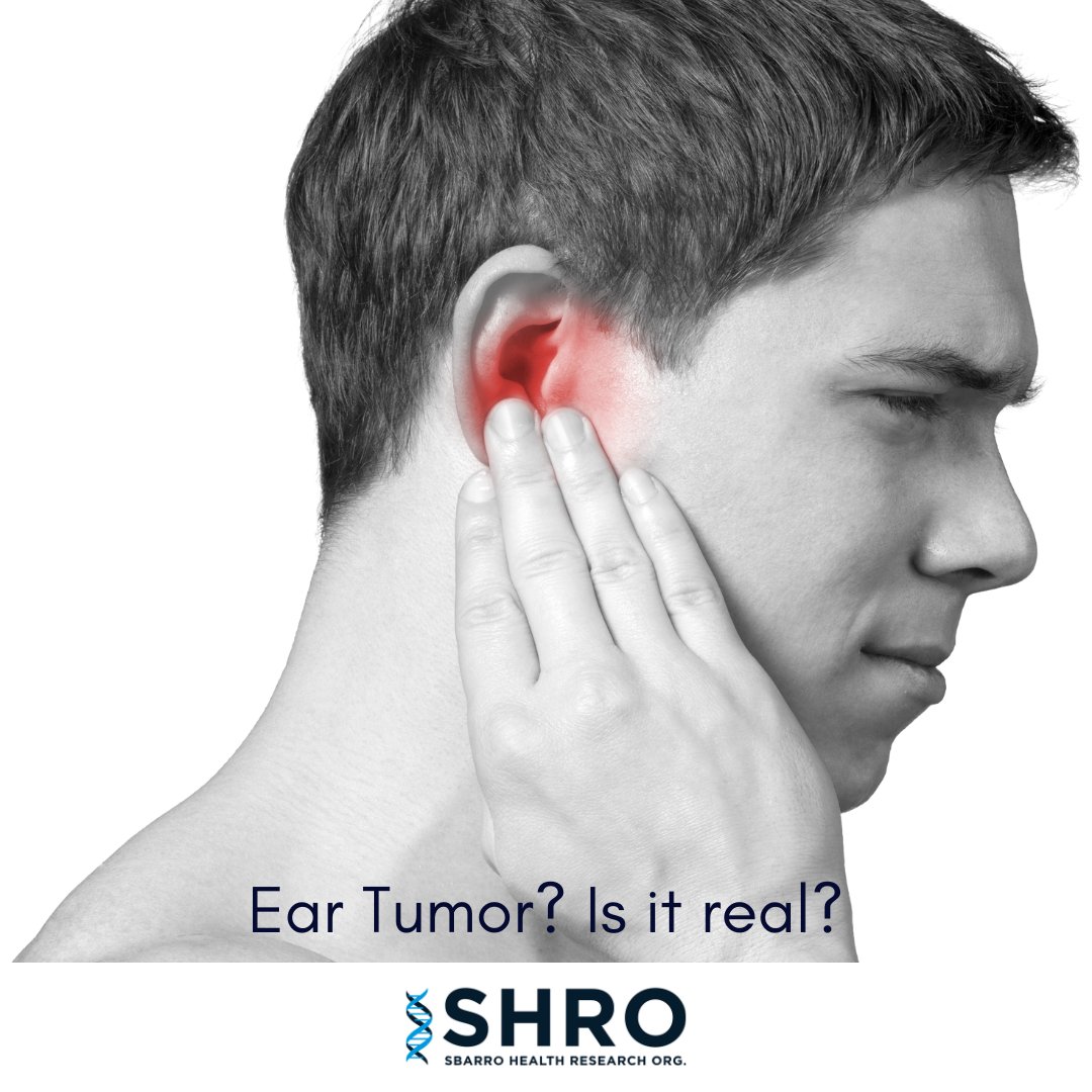 sbarro_health's tweet photo. Ear Tumor? Is it real?
Ear cancer may also start from within the ear. It can affect the bone inside the ear, called the temporal bone.
#SHRO #MadeAtSHRO #DiscoveredAtSHRO #sbarroinstitute #antoniogiordano #templemade #EndCancer #rarecancer #cancer #cancerawareness #cancer https://t.co/qMtuuYGUCK