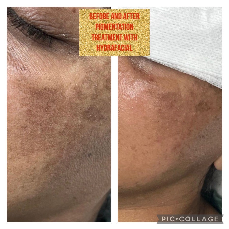 ColonialCRE_'s tweet photo. Check Out Eyebrow Express Beauty Salon for Absolutely Stunning Results!

10% off any service if you mention this ad!

Eyebrow Express Beauty Salon
5521 South Hulen Street
Fort Worth, TX
https://t.co/SDOfmRUWua

#eyebrowexpressbeautysalon #eyebrowexpress #beautysalon https://t.co/vGXDN2FAZk