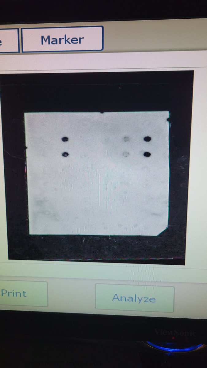 First ever dot blot worked! So excited to have some really cool data for my semimar talk 🥳 #phdlife