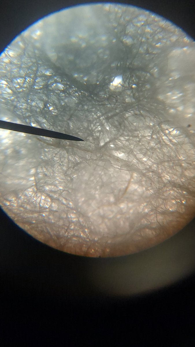 RiedelSCIENCE's tweet photo. Nope. Not the moon...it's a paper towel! @MMS_WOLVES captured photos of everyday items under the microscope this week. @correllscience #MMSscience #fcps1sails https://t.co/fJcYtbxcmB