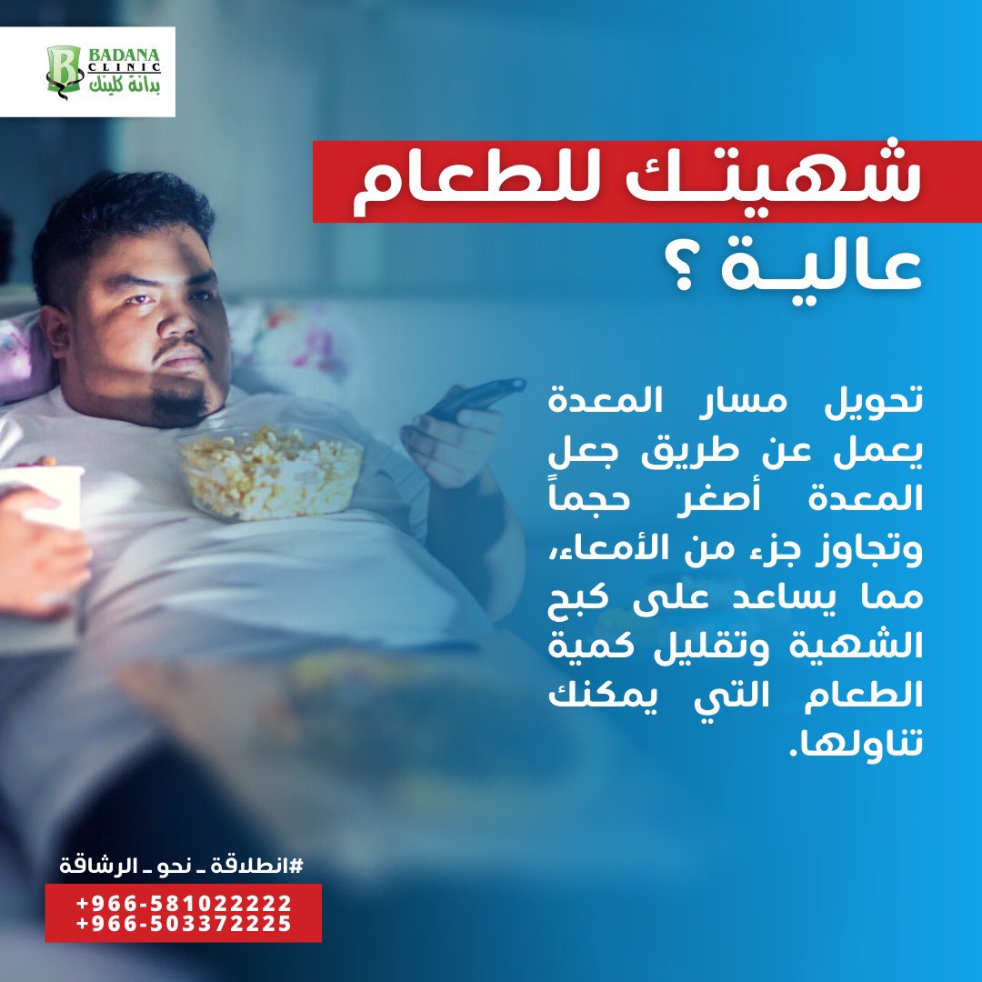 #رابطة_المتكممين #تكميم_المعدة #التكميم #بدانة_كلينك #سلطان_التمياط