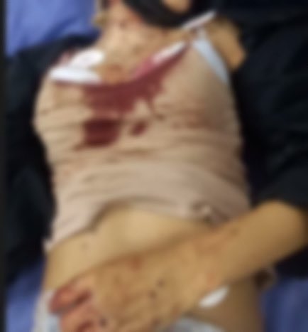 idkidontkidknow's tweet photo. Do not sleep on Iran! Innocent people are being killed! They shut the internet down! These photos were taken today! So many people have been killed! #مهسا_امینی #MahsaAmini https://t.co/EEc1TIRu6X