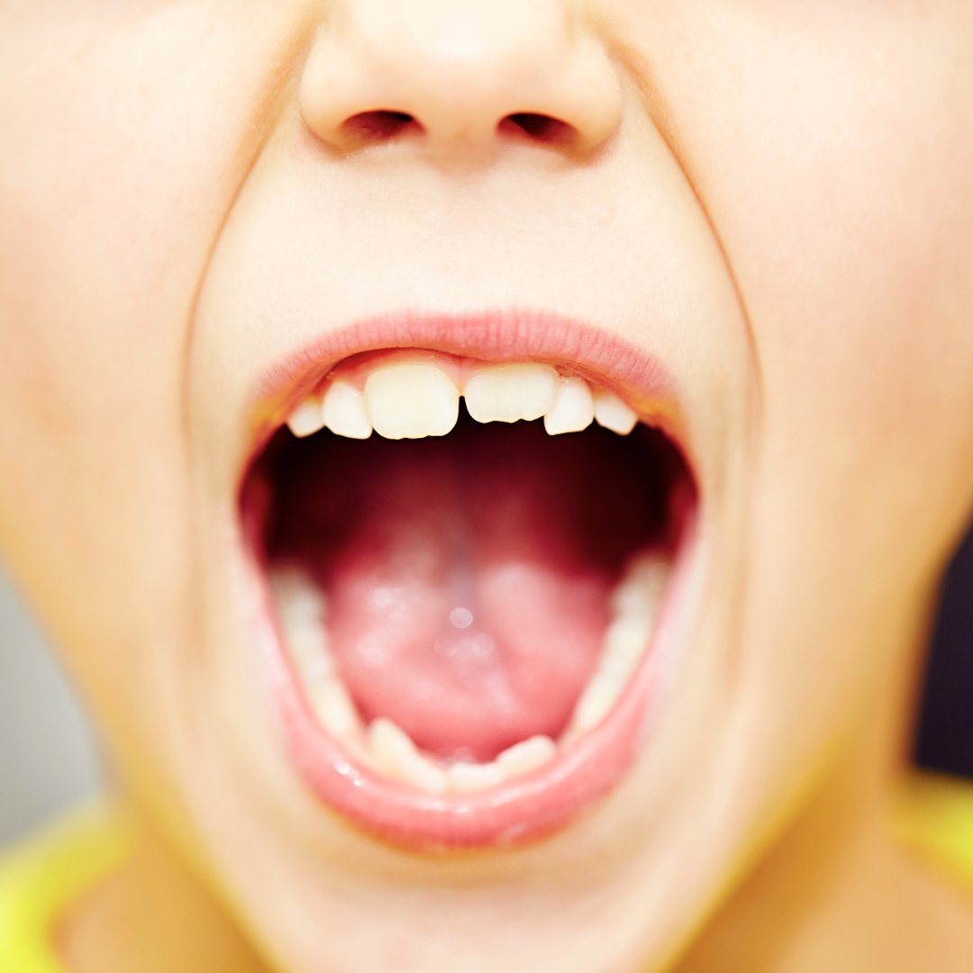 Is It Possible to Reverse Tooth Decay?

carrieibbetson.com/blog/is-it-pos…