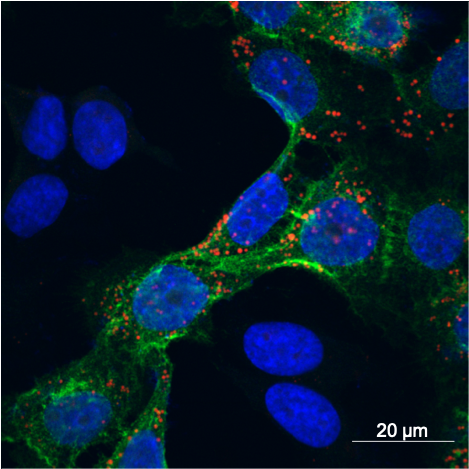 Masako Harada, PhD was awarded a $192k grant by the Elsa U. Pardee Foundation to work on a therapeutic miRNA delivery system based on cell-derived extracellular vesicles, which could provide new approaches to treating tumors.

Read more: bit.ly/3rfRpwp