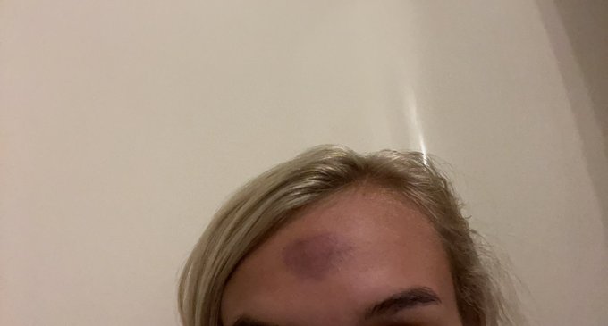 I was on FaceTime with bri showing her my new dildo and decided to suction it to my forehead 😂😂😂 it gave<a href="/tag/onlyfans"class="tags"><span>#onlyfans</span></a><a href="/tag/onlyfansgirl"class="tags"><span>#onlyfansgirl</span></a>