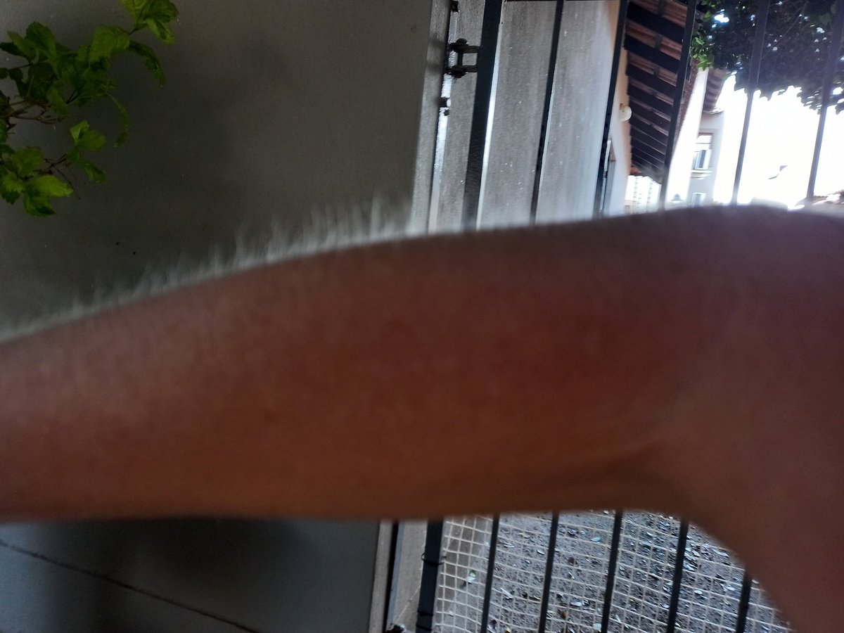 E S M A R On Twitter Hoendervleis Se Moses Ek Kry Nou Koud My Arm