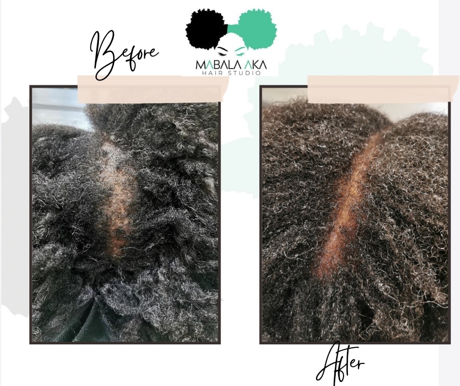 PMaseko's tweet photo. Alopecia/ Hair loss is a reality for many women. We have found in many cases that if detected and attended to early, many of our hair loss challenges can be resolved.

Visit Mabala Aka Hairstudio in Irene, Centurion 
Book an appointment 📞0813336302 
#healthyhair #naturalhair https://t.co/1w4M6Cr9cQ
