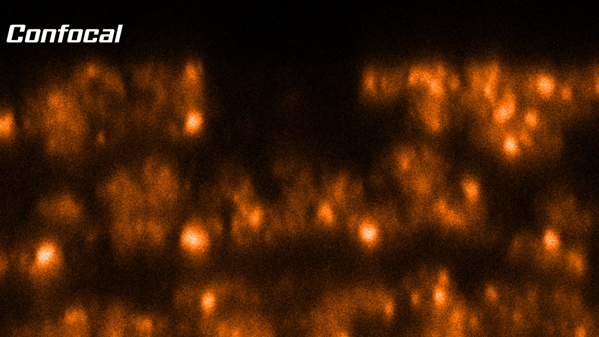 MeschkatMartin's tweet photo. More images we acquired during our joint workshop #EMBLSTED_MINFLUX at @EmblImaging @Abberior 

Enjoy some impressions from our session on TISSUE #STED 
Swipe right for #STED &amp; #confocal image.
@EMBLEvents @EMBLHeidelberg

#microscopy #superresolution #MATRIX #3DSTED #Drosophila https://t.co/DfIOsjSx5q