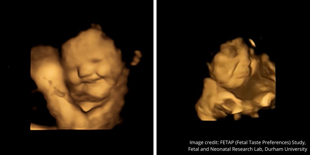 durham_uni's tweet photo. Keen on carrot, not so keen on kale… 

Fetuses make “laugh” or “cry” faces in reaction to different flavours according to @FetalLab @DurhamPsych. 

This is the 1st direct evidence that fetuses react differently to various tastes &amp; smells in the womb 👉 https://t.co/13UKS7IjVM https://t.co/xAqXGDqxQl