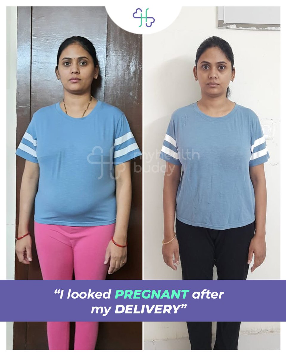 Myhealthbuddy11's tweet photo. Postpartum weight loss journey of our client, Himadri Yadav from New Delhi 👇

Starting weight : 60 Kgs
Current Weight : 56 kgs
Duration : 12 weeks
Sign up with us :https://t.co/v57r8DwHC4 https://t.co/cQAAtVgSC2