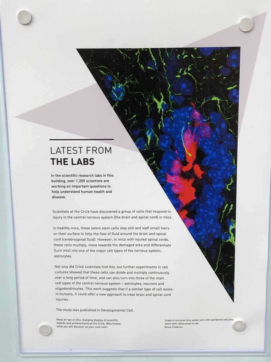 brunoagf's tweet photo. When your research is featured next to the Nobel prize medal. Surely, a good omen! @ReiseSousaLab @TheCrick https://t.co/NPDYba7kuC