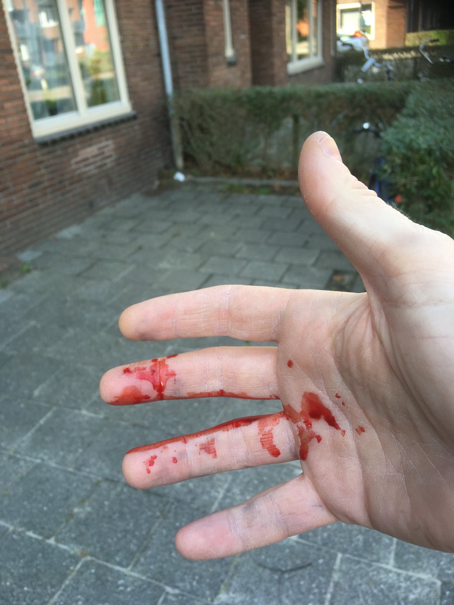 DeDoentje's tweet image. Het lot van een postbode. Gebeten of gekrabd door een kat aan de andere kant van de brievenbus. Een behulpzame buurman hielp me om mijn vinger te verbinden en kon mijn hand schoonmaken. #Groningen #Postbode #PostNL