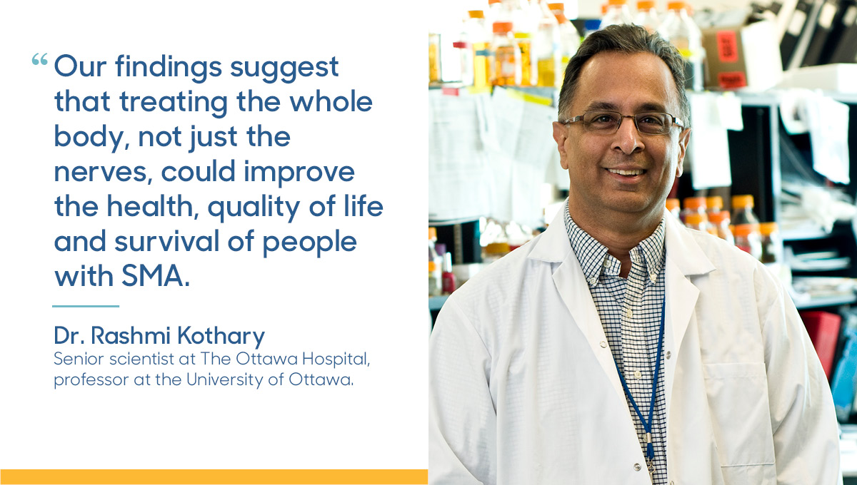 Whole-body approach needed to treat neuromuscular disease SMA ohri.ca/newsroom/story…
