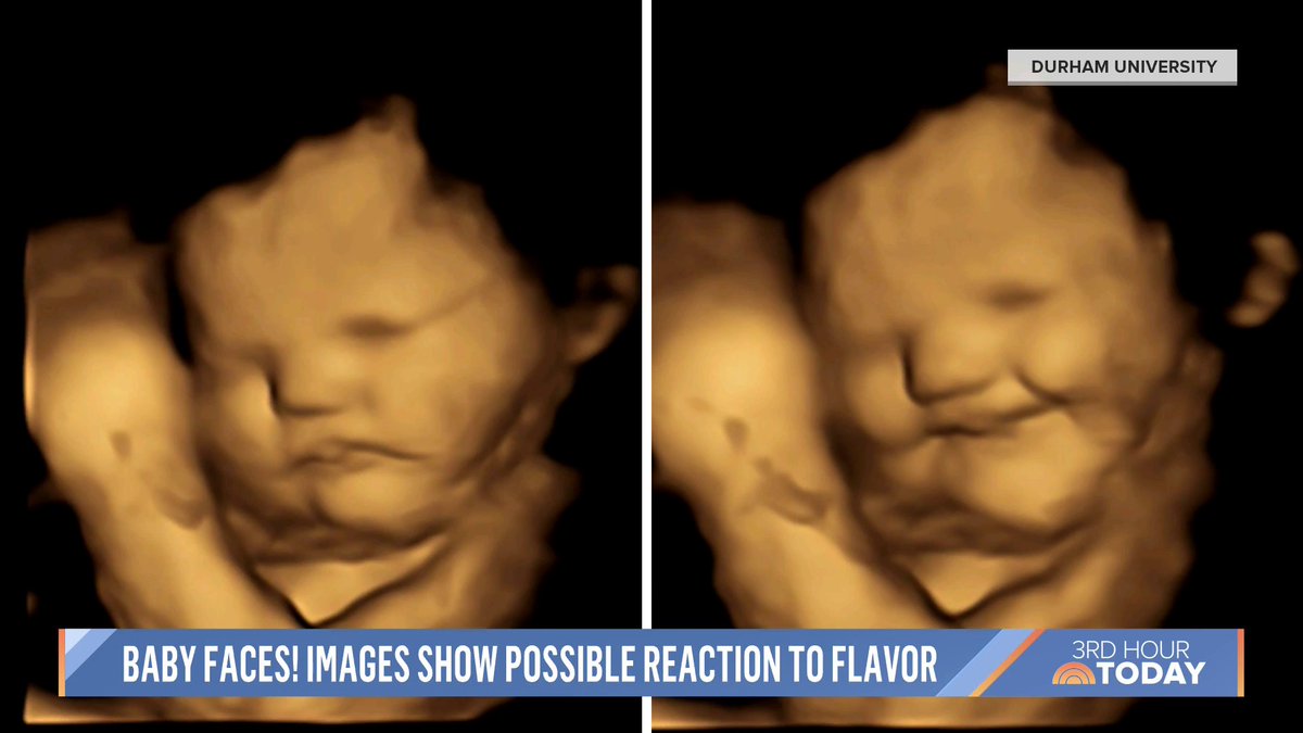 These images from researchers show that babies in the womb can possibly react to flavor. 