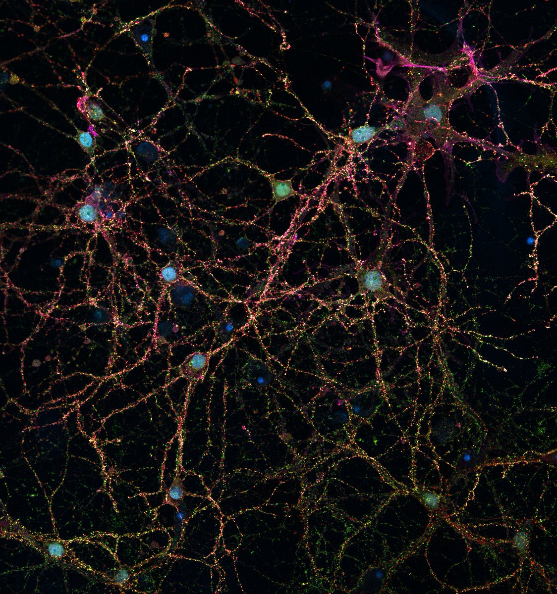 MeschkatMartin's tweet photo. Superresolved synapses at #EMBLSTED_MINFLUX @EmblImaging Primary rat neurons - Homer and Bassoon labeled with #abberior STAR #dyes.

@EMBLEvents @EMBLHeidelberg @Abberior
#microscopy #STED #superresolution #MATRIX https://t.co/UPjk2tMWyR