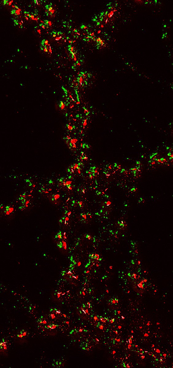 MeschkatMartin's tweet photo. Superresolved synapses at #EMBLSTED_MINFLUX @EmblImaging Primary rat neurons - Homer and Bassoon labeled with #abberior STAR #dyes.

@EMBLEvents @EMBLHeidelberg @Abberior
#microscopy #STED #superresolution #MATRIX https://t.co/UPjk2tMWyR
