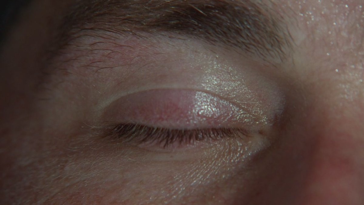 everydaylostt's tweet photo. Jack's eye opens for the first time in the island https://t.co/HXQ0Ex0fUZ