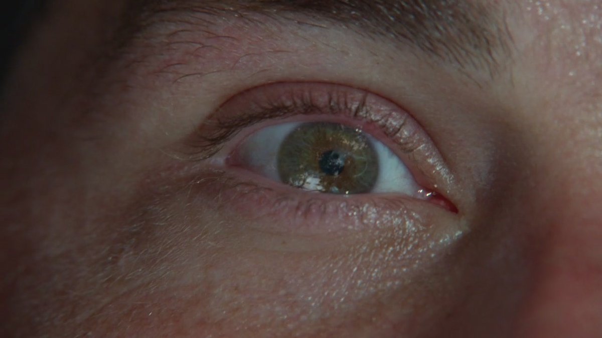 everydaylostt's tweet photo. Jack's eye opens for the first time in the island https://t.co/HXQ0Ex0fUZ