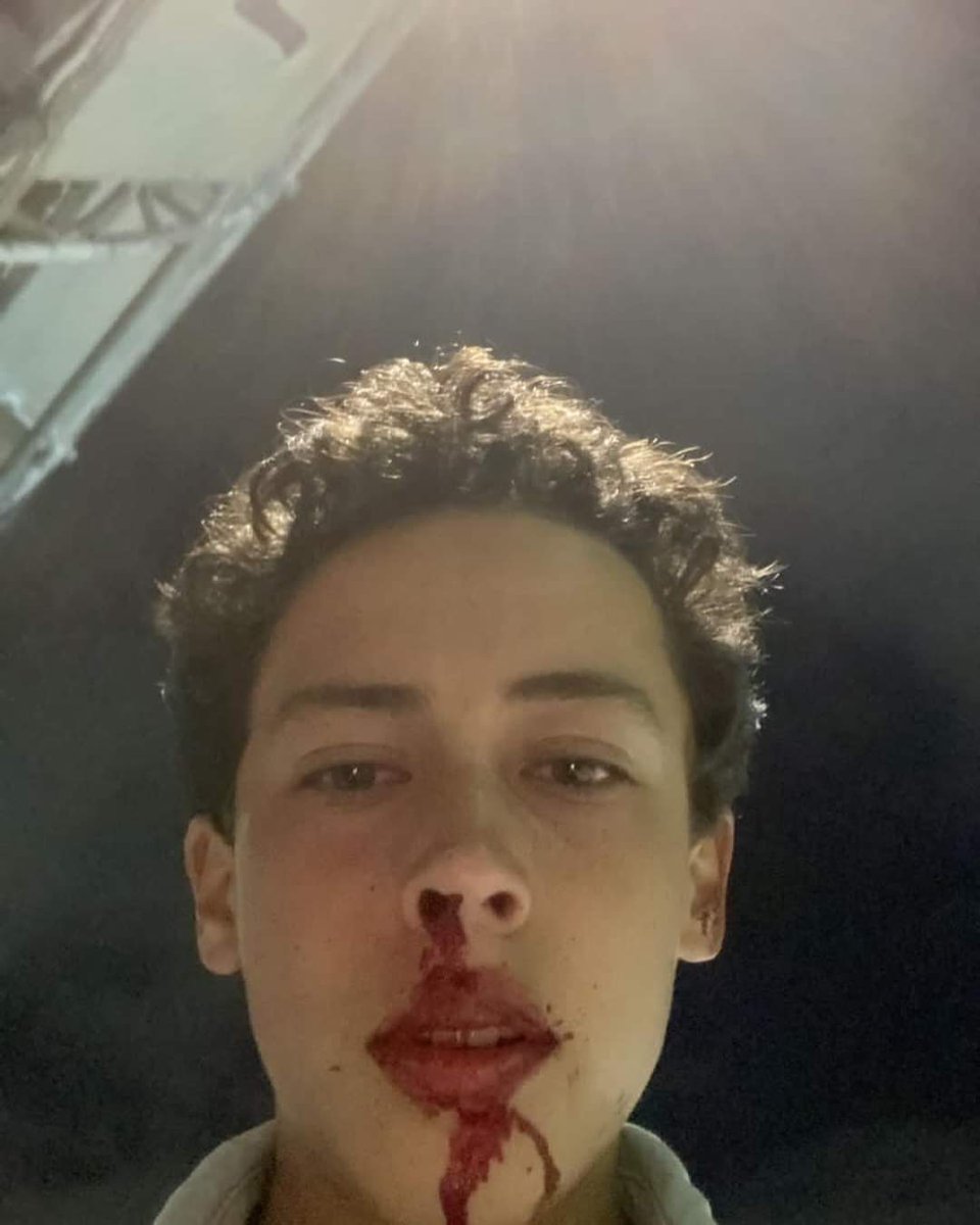 ocho8seis6ocho8's tweet photo. Este señor golpeó a un jovencito de 14 años que intentaba entrar al concierto de Dua Lipa anoche. 😡
Abajo te pongo lo que su madre publicó 
Ayuda para que se haga viral porfa!
@ocesa @SSC_CDMX https://t.co/JdAdOsMeE8