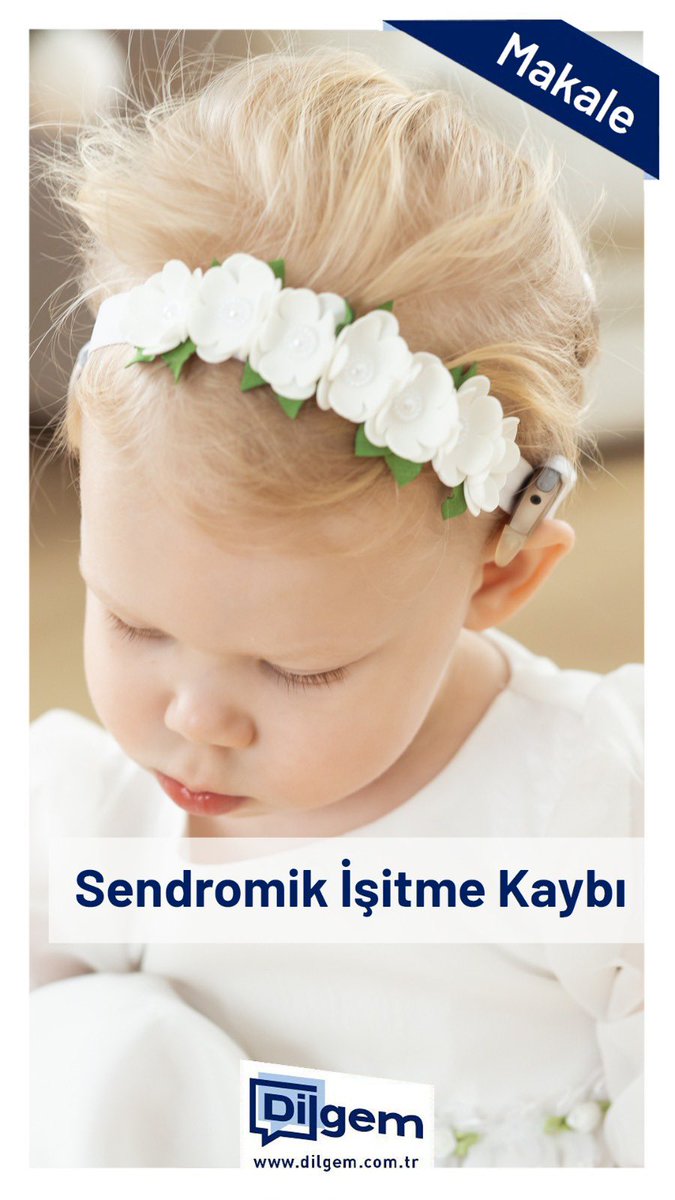 dilgemcomtr's tweet photo. Sendromik işitme kaybı, işitme bozukluğunun diğer durumlarla ilişkili olduğu anlamına gelir. Kalıtsal işitme bozukluklarının %30’u sendromiktir. 
Şu anda böbrekler, gözler ve kalp dahil olmak üzere vücudun çeşi

Makalenin devamını okumak için tıklayınız: 
https://t.co/2LIAMJeWre https://t.co/22xySwq8eO
