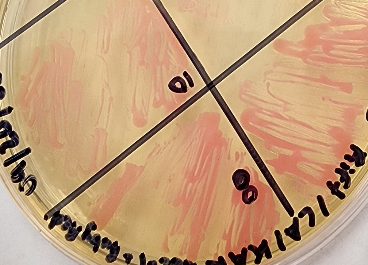 revealplant's tweet photo. So proud 👏 👏 of my undergrad student researchers #ECSU. First time the lab placing plasmid RUBYRED @ATinyGreenCell in Agro AGL-1 with modified protocol (no liq N). Colonies 🔴🔴 (only need 1😊). Now onto transformation of tomato, tobacco, WFP....... #HBCU #undergradsinthelab https://t.co/iYe5ay4fQq