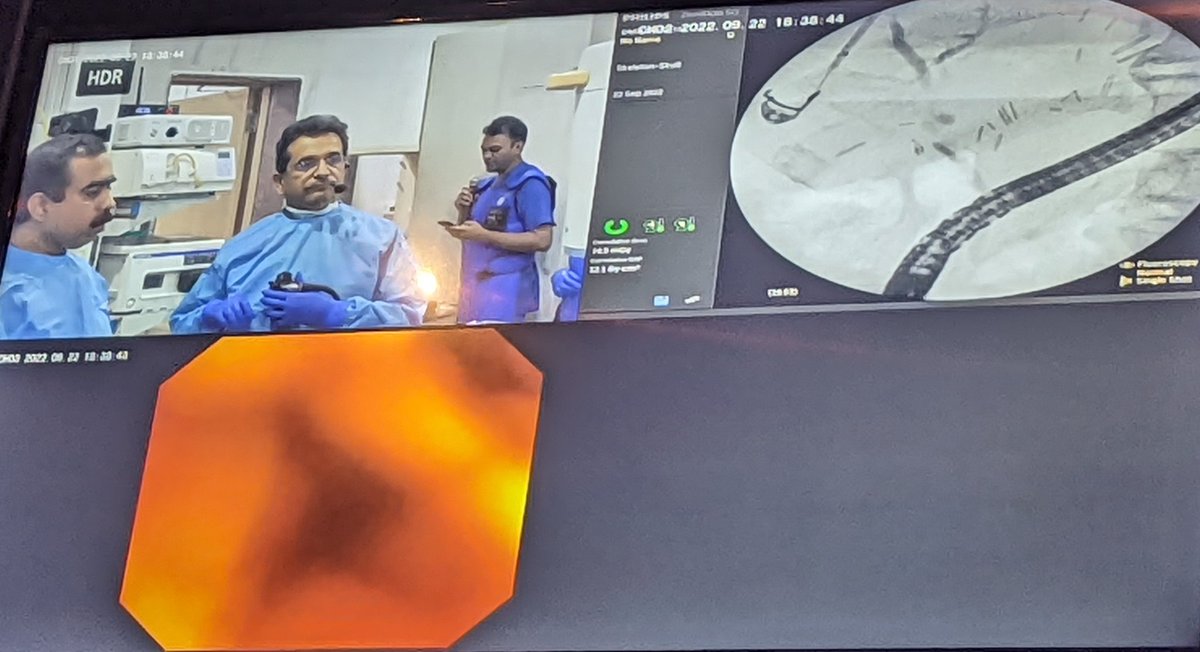 Srisha_Hebbar's tweet photo. 4 hours. 14 advanced PB endoscopy cases showcased by 2 World class centres (AIG, Hyderabad and Deenanth Mangeshkar, Pune). It was an educational treat to the British PB endoscopists @DrLakhtakia @amolbapaye @UHNMEndoscopyTC #stokeercpeus22 https://t.co/dd47ddkOlt