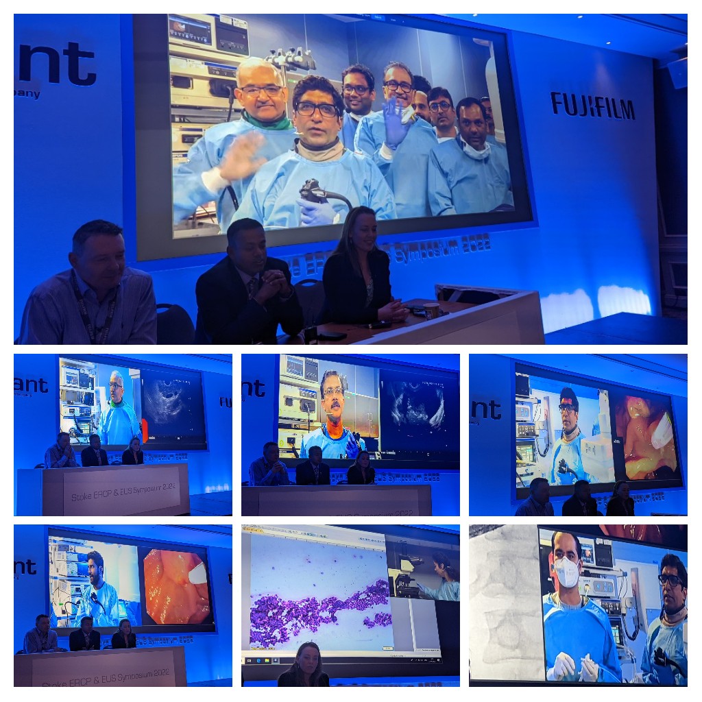 Srisha_Hebbar's tweet photo. 4 hours. 14 advanced PB endoscopy cases showcased by 2 World class centres (AIG, Hyderabad and Deenanth Mangeshkar, Pune). It was an educational treat to the British PB endoscopists @DrLakhtakia @amolbapaye @UHNMEndoscopyTC #stokeercpeus22 https://t.co/dd47ddkOlt
