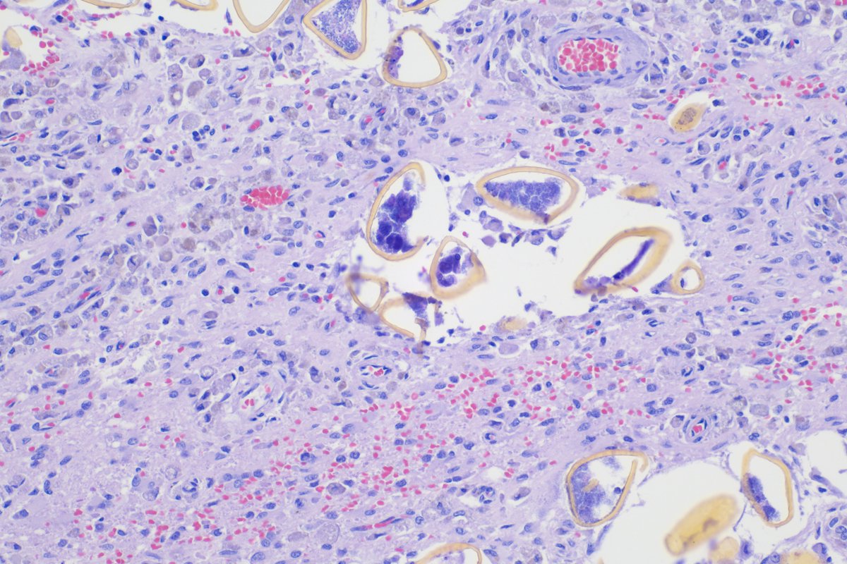 This harbor porpoise definitely has something in the brain that does not belong there