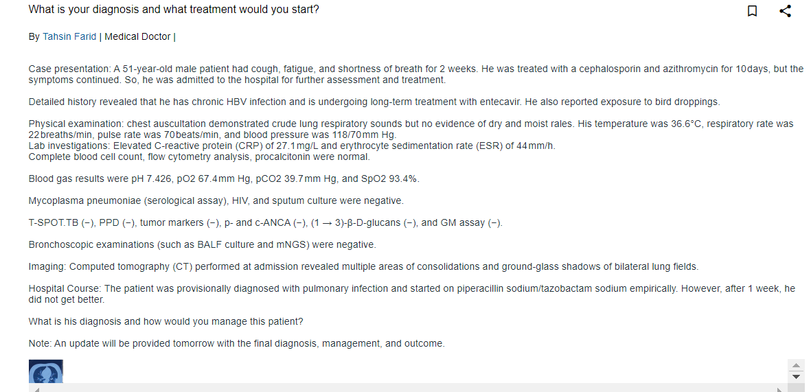 51 Y M with Hep B, presented with cough, fatigue, and shortness of breath. Treated with oral antibiotics for 10 days and then piperacillin/tazobactam for 1 week in hospital w/o improvement. What is your #diagnosis and #treatment?cure.ncats.io/explore/discus…
#fungaldiseaseawarenessweek