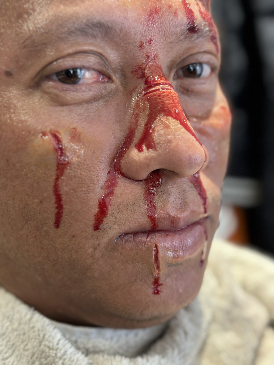 SaviourMedical's tweet photo. THIS IS SIMULATION **. Final day 3 of the Saviour Medical Zero-Hero Moulage Course and candidates getting to grip with flat moulds. Brilliant application from a candidate after only 3 days of training. 👏🏻 https://t.co/3EvLeIGQ78