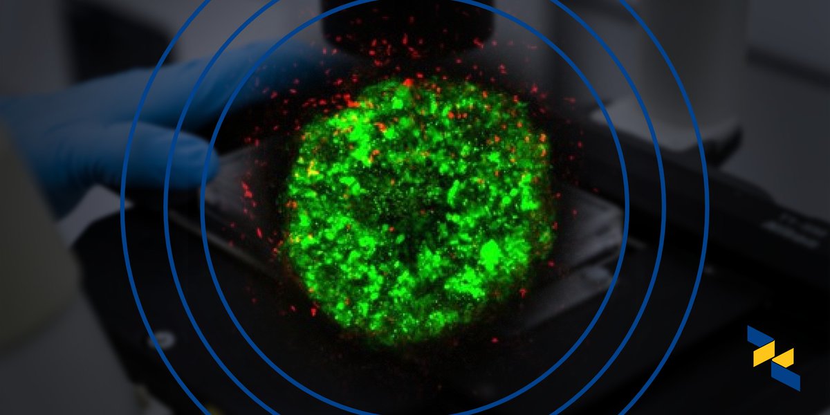 AIM Biotech (@aimbiotech) on Twitter photo Work w/ patient tumor biopsies or tumor #organoids in your #cancerresearch? Wish there was a better way to characterize patient-specific tumor tissue to guide functional #precisionmedicine?
We can help—follow <a href="/AIMBiotech/">AIM Biotech</a> & watch for the October release of our organiX platform! Work w/ patient tumor biopsies or tumor #organoids in your #cancerresearch? Wish there was a better way to characterize patient-specific tumor tissue to guide functional #precisionmedicine?
We can help—follow <a href="/AIMBiotech/">AIM Biotech</a> & watch for the October release of our organiX platform!