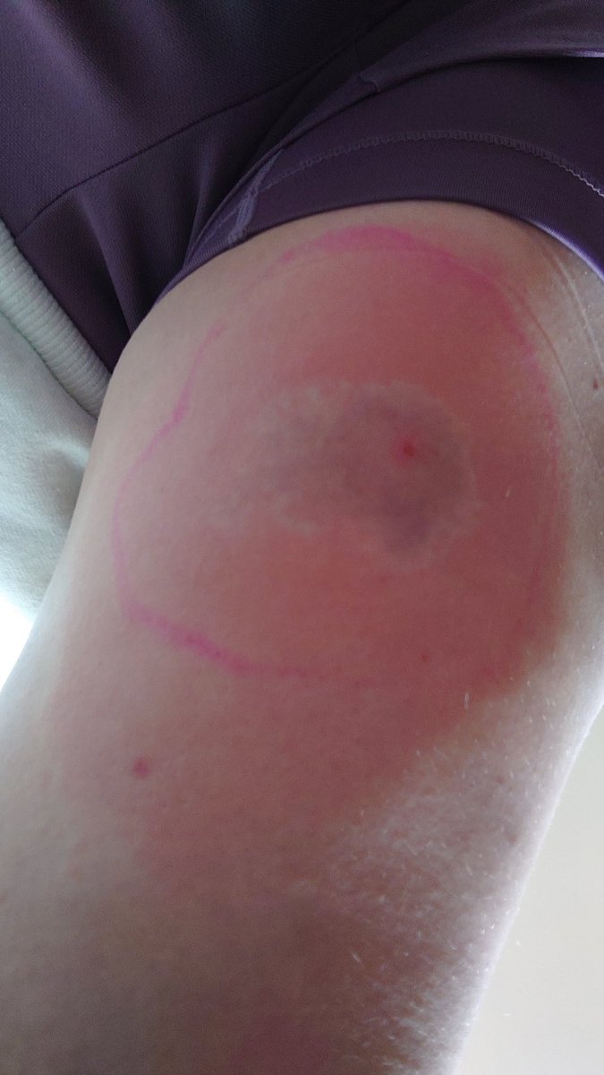 Amie Lake-Knott. tweet media