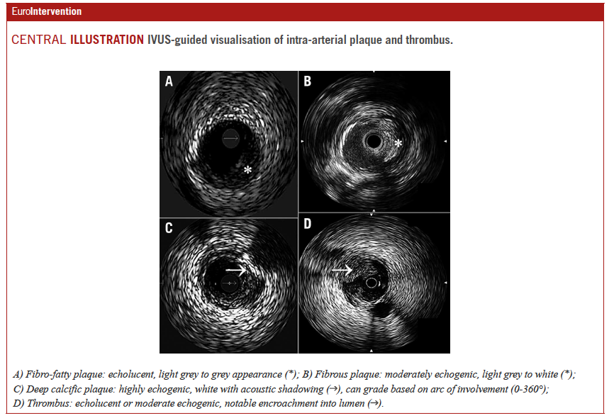 EuroIntervention on Twitter "This review provides an update in the use