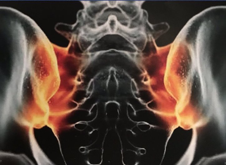 AStretch_Physio's tweet photo. More @britspauk conference pearls! 
Misdiagnosis risk in #AxSpA
👉🏼BMO can still be present on MRI scan 1 yr post partum
👉🏼x-ray = neither sensitive/ specific for diagnosis of AxSpA therefore ASAS diagnostic criteria no longer need X-ray
#BRITSpA22 https://t.co/sitcflB2EE