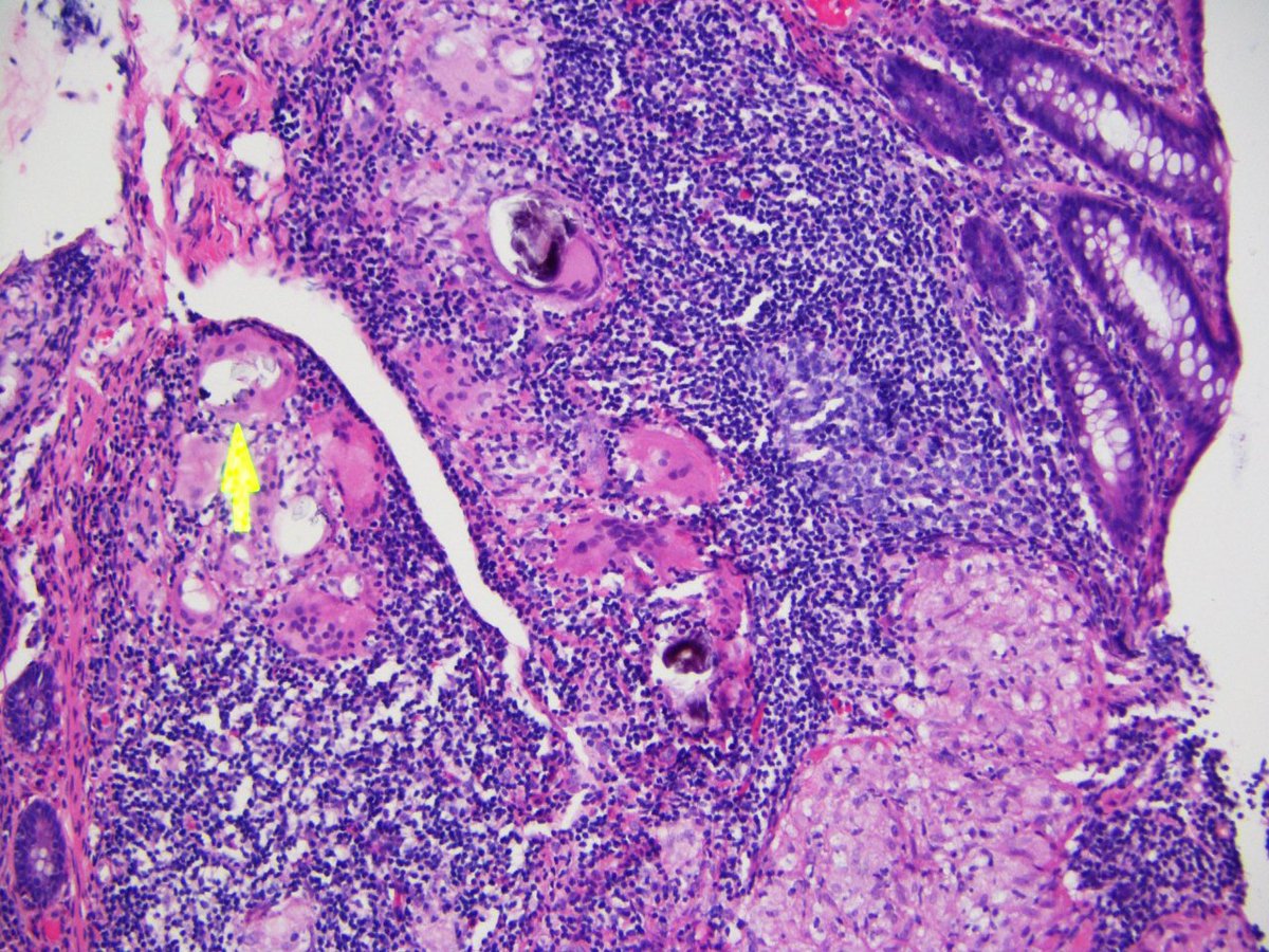 Nicole Arva, MD/PhD tweet media