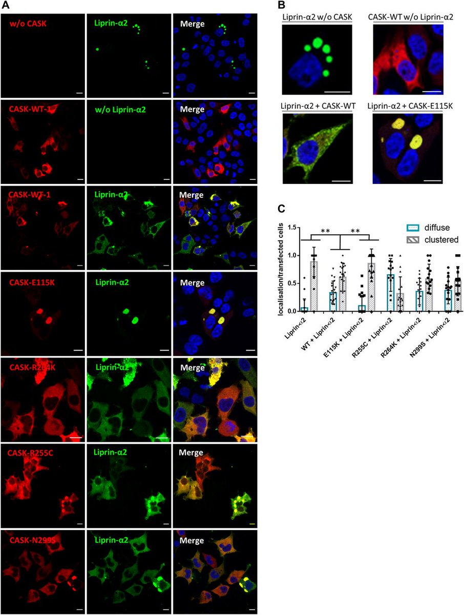 LSAjournal's tweet photo. Check out this new article in LSA!

Patient missense variants in CASK interfere with binding to, and regulation of condensate formation of Liprin-alpha 2. 

@KreienkampL

https://t.co/Bu1MM909Py https://t.co/pbDEVOSI0P