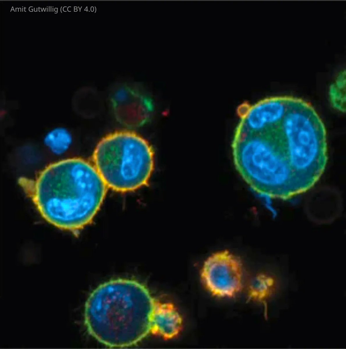 eLife's tweet photo. Cancer cells hide inside other cancer cells when the immune system attacks, letting the cell inside survive. https://t.co/lfMHSYiHZO https://t.co/1isuN1V52k