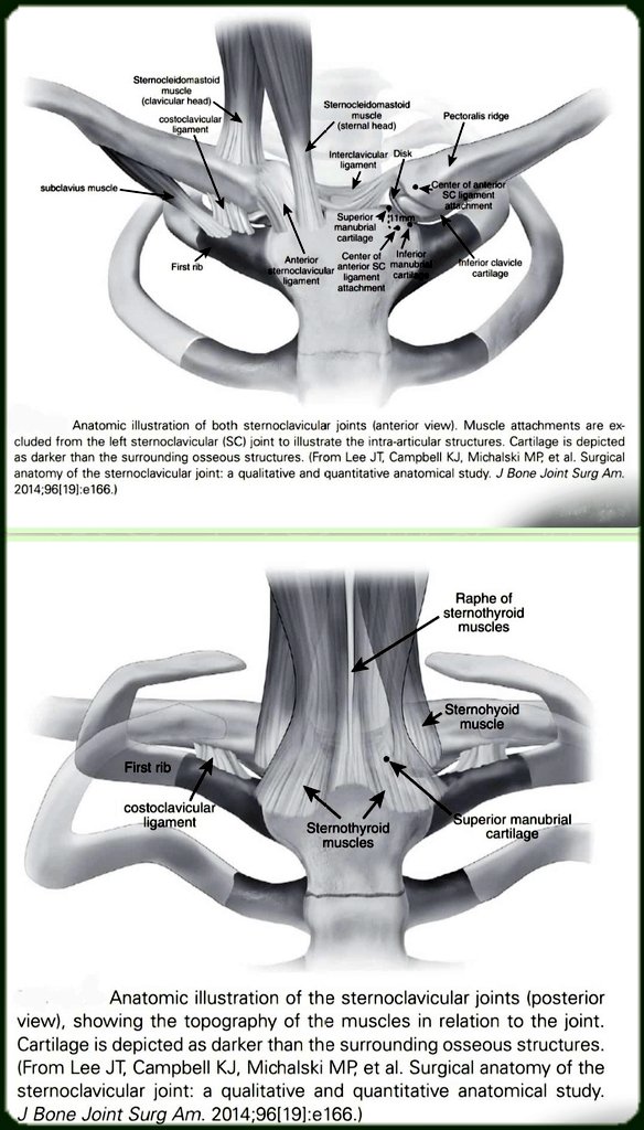 OBandarchi's tweet photo. 🔴One of the best anatomic illustrations of both sternoclavicular joints that I've ever seen👌The main function of the sternoclavicular joint is to coordinate the movements of upper limb with the core of the body.Thus allowing the upper limb to perform its full range of motio https://t.co/AnuAowYNWu